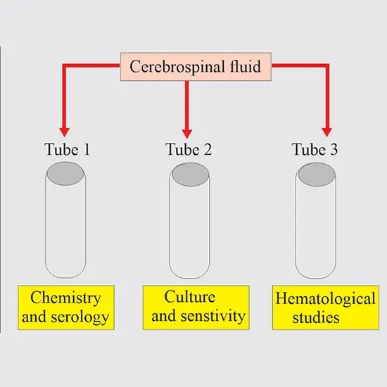 Cerebrospinal Fluid (CSF) Examination Routine